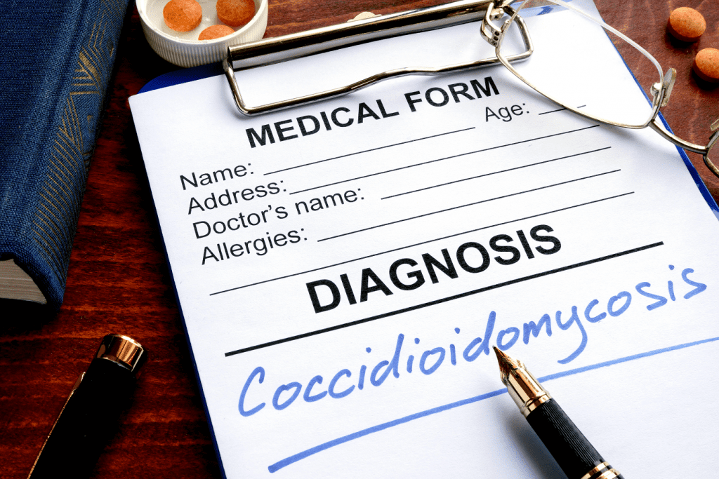 Coccidioidomycosis Diagnosis